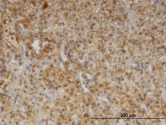 H00001039-M02 - CDR2