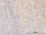 H00001072-M04 - Cofilin-1