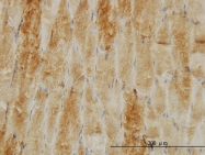 H00001073-M03 - Cofilin-2