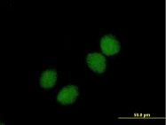 H00001120-B01P - Choline Kinase beta