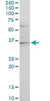 H00001123-M03 - ARHGAP2 / CHN1
