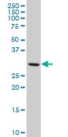 H00001155-A01 - CKAP1 / TBCB