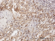 H00001200-B01P - Tripeptidyl-peptidase 1 (TPP1)