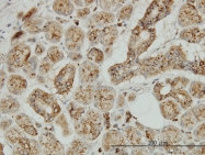 H00001200-M01 - Tripeptidyl-peptidase 1 (TPP1)