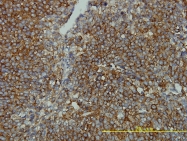 H00001212-M01 - Clathrin light chain B