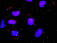 H00001213-M05 - Clathrin heavy chain