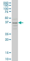 H00001231-M01A - CD192 / CCR2