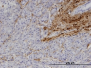 H00001277-M01 - Collagen type I