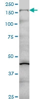 H00001289-M01 - Collagen type V