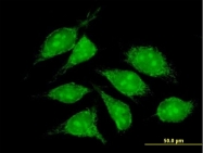 H00001329-B01P - Complex IV subunit Vb