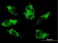H00001340-B01P - Complex IV subunit VIb