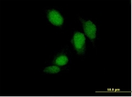 H00001385-B01 - CREB1