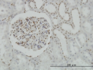H00001385-M02 - CREB1