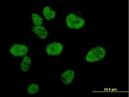 H00001387-M01 - CREB-binding protein