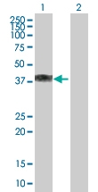H00001404-B01P - Proteoglycan link protein / HAPLN1
