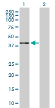 H00001404-D01P - Proteoglycan link protein / HAPLN1