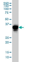 H00001406-M02 - OTX3 / CRX