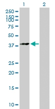 H00001432-B01P - MAP kinase p38 alpha / MAPK14