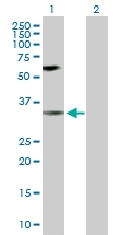 H00001432-D01P - MAP kinase p38 alpha / MAPK14