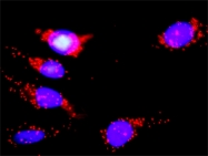 H00001432-D01P - MAP kinase p38 alpha / MAPK14
