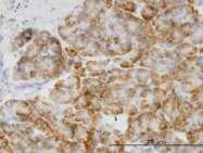 H00001432-M01 - MAP kinase p38 alpha / MAPK14