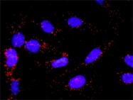 H00001432-M01 - MAP kinase p38 alpha / MAPK14