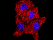 H00001432-M01 - MAP kinase p38 alpha / MAPK14