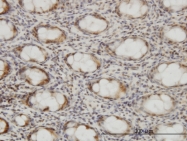 H00001434-M03 - XPO2 / Exportin-2