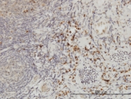 H00001434-M05 - XPO2 / Exportin-2