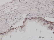H00001434-M08 - XPO2 / Exportin-2