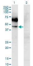 H00001438-M03 - CD116 / CSF2RA