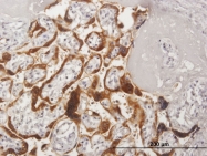 H00001443-B02 - Placental Lactogen