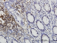 H00001445-M01 - CSK