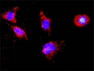 H00001453-M09 - Casein kinase I delta