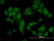 H00001457-M01 - Casein kinase II subunit alpha