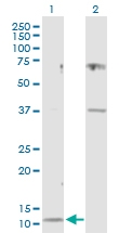 H00001471-D01P - Cystatin-C