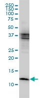 H00001476-M01 - Cystatin-B