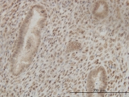 H00001478-M01 - CSTF2