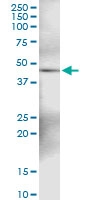 H00001491-D01 - CTH