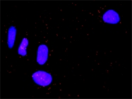 H00001493-M08 - CD152 / CTLA4