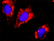 H00001499-M02 - Catenin beta-1