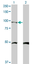 H00001499-M03 - Catenin beta-1
