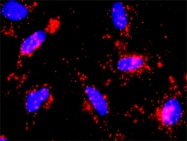 H00001499-M06 - Catenin beta-1