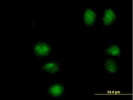 H00001500-B01 - Catenin delta-1