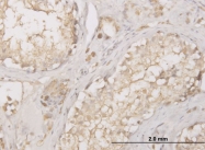 H00001509-M01 - Cathepsin D