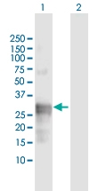 H00001511-D01 - Cathepsin G