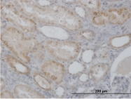 H00001512-B01P - Cathepsin H