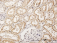H00001512-B02 - Cathepsin H