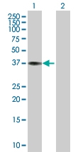H00001513-D01P - Cathepsin K
