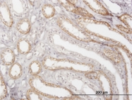 H00001513-M01 - Cathepsin K